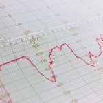 Temperature readings