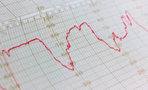 Temperature Monitor Calibration Certificate